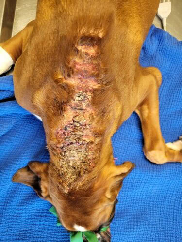 Un cas de calcinose cutanee associee a un syndrome de cushing iatrogene et traitee a la colchicine