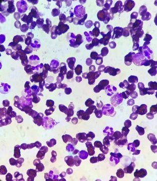 Un cas de furonculose éosinophilique chez un chien
