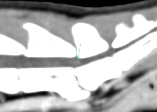 Un cas de syndrome d’hyperesthésie féline avec automutilation de la queue Scanner d'un chat : lésion intradurale rehaussante en regard de L7-S1