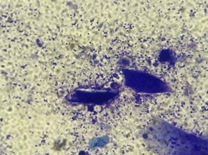 Intérêt de la BMF lors de la prise en charge de chéilite à Pseudomonas Intérêt de la BMF lors de la prise en charge de chéilite à Pseudomonas