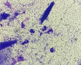 Intérêt de la BMF lors de la prise en charge de chéilite à Pseudomonas Intérêt de la BMF lors de la prise en charge de chéilite à Pseudomonas