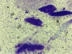 Intérêt de la BMF lors de la prise en charge de chéilite à Pseudomonas Intérêt de la BMF lors de la prise en charge de chéilite à Pseudomonas