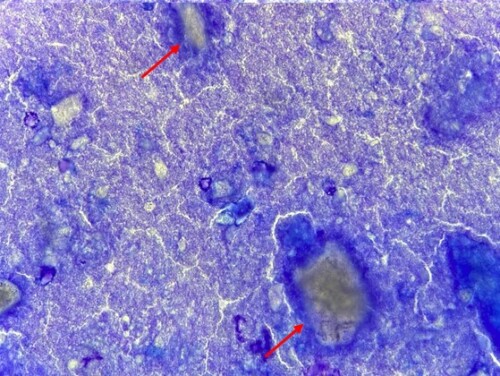 Un cas de calcinose circonscrite chez un chiot Berger allemand