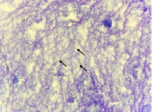 Un cas de calcinose circonscrite chez un chiot Berger allemand