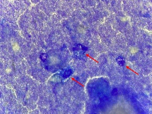 Un cas de calcinose circonscrite chez un chiot Berger allemand