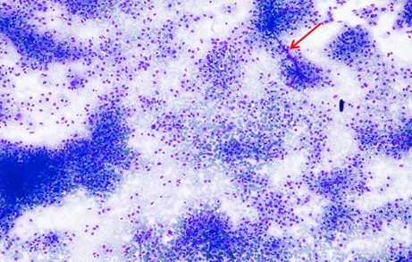 Un cas de xanthogranulome chez un Bullmastiff