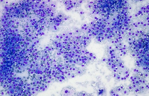 Un cas de xanthogranulome chez un Bullmastiff