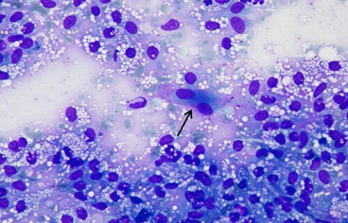 Un cas de xanthogranulome chez un Bullmastiff