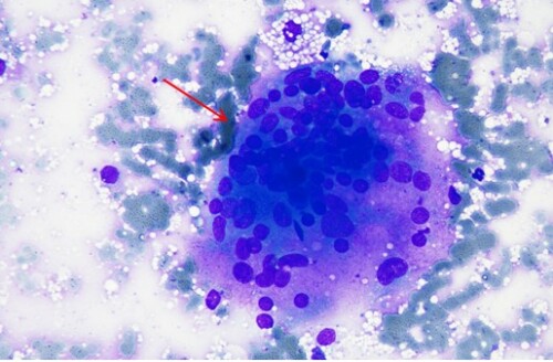 Cytologie clinique