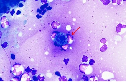 Cytologie clinique