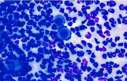 Un cas de pemphigus foliacé chez un chat