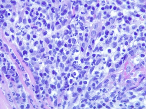 Discussion à propos d’un cas de dermatite lichénoïde psoriasiforme atypique chez une chienne Fox-Terrier.