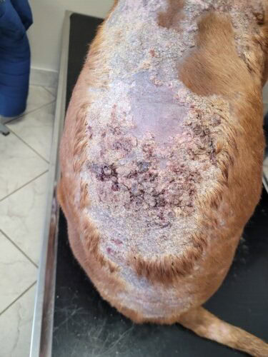 Un cas de calcinose cutanee associee a un syndrome de cushing iatrogene et traitee a la colchicine