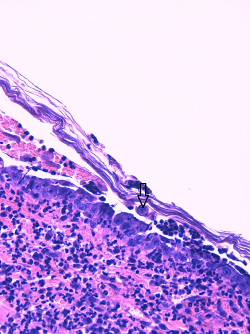 Visualisation de cellules acantholytiques (X400, LAPVSO)