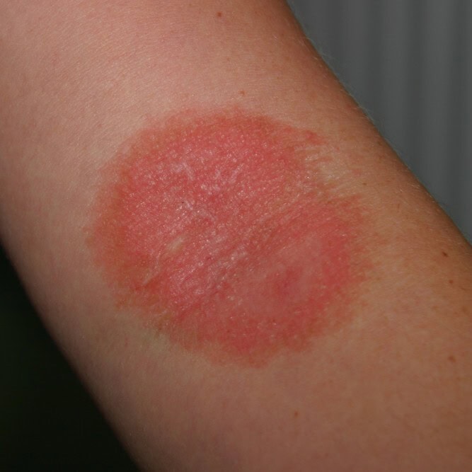 Formation continue en Dermatologie Vétérinaire depuis 25 ans !