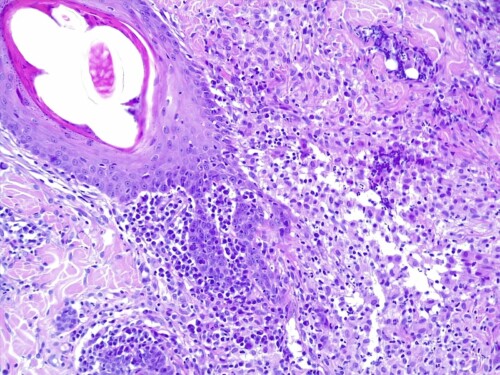 Un cas d’osteoma cutis chez un terrier