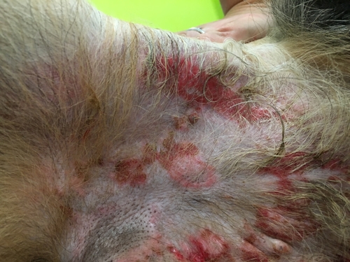 Un cas de lupus vésiculeux photoaggravé chez un Berger allemand