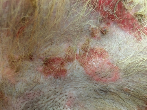 Un cas de lupus vésiculeux photoaggravé chez un Berger allemand