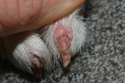 IMG 4277 Symmetrical lupoid onychodystrophy