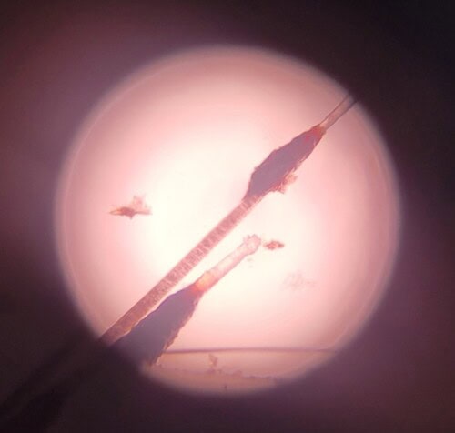 Dysplasie des follicules pileux noirs chez un Border Collie