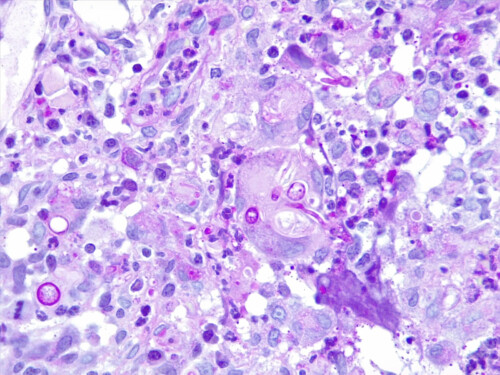 Un cas de dermatomycose à Penicillium associée à un syndrome d’Ehlers-Danlos chez un chien