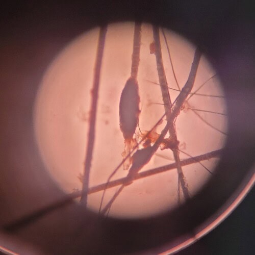 Dysplasie des follicules pileux noirs chez un Border Collie