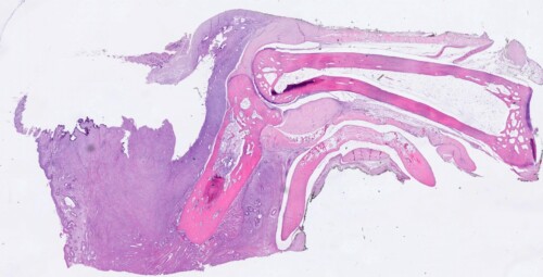 Un cas atypique de metastases digitees de tumeur pulmonaire chez un chat Micrographie de tissus humains, montrant des structures cellulaires en teintes de rose et violet, utilisé en histologie pour l'étude des cellules et tissus.
