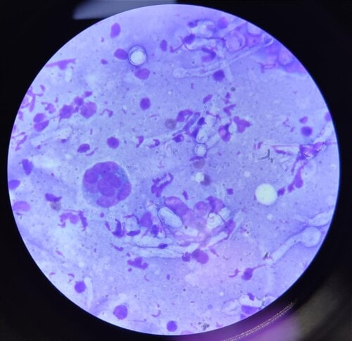 Un cas de dermatomycose à Penicillium associée à un syndrome d’Ehlers-Danlos chez un chien