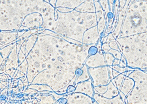 Un cas de dermatomycose à Penicillium associée à un syndrome d’Ehlers-Danlos chez un chien