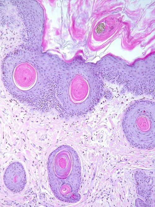 Un cas de dermatomyosite original chez un Beauceron