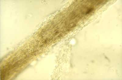 Actualités dans le traitement des dermatophytoses canine et féline photo2