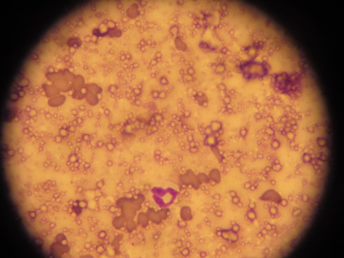 Calcinose cutanée sur un chat insuffisant rénal