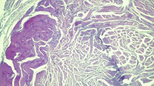 Dermatofibrose nodulaire chez un chien croisé malinois