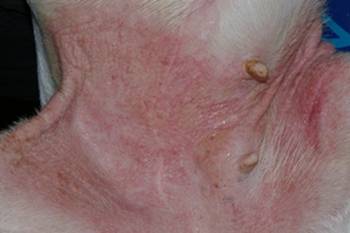 Un cas d'allergie de contact Un cas d'allergie de contact