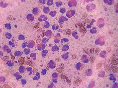 Un cas de granulome éosinophilique chez un chat, traité avec Cortavance® Un cas de granulome éosinophilique chez un chat, traité avec Cortavance®