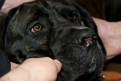 Un cas d'artérite du philtrum nasal Un cas d'artérite du philtrum nasal