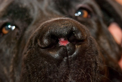 Un cas d'artérite du philtrum nasal Un cas d'artérite du philtrum nasal