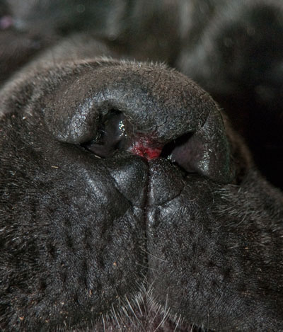 Un cas d'artérite du philtrum nasal Un cas d'artérite du philtrum nasal