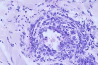 Un cas de leishmaniose pustuleuse chez un chien