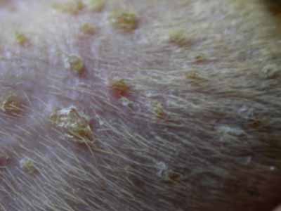Un cas de leishmaniose pustuleuse chez un chien