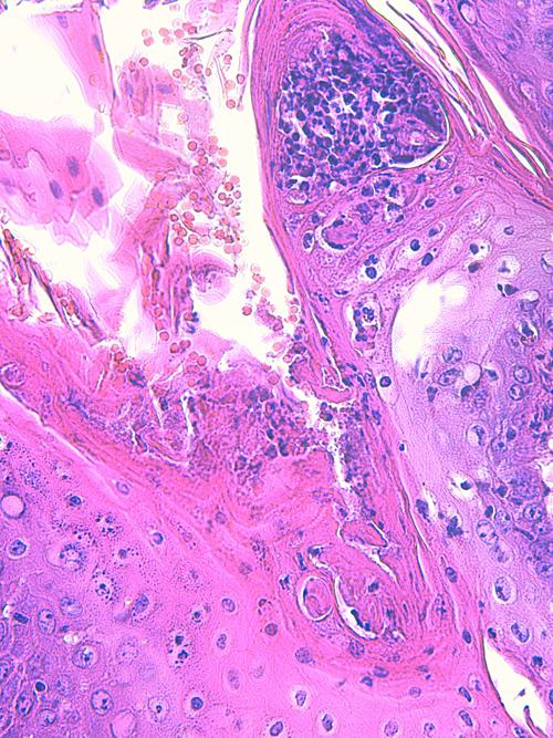 Un cas de pododermatite à ankylostomatidés chez un chien