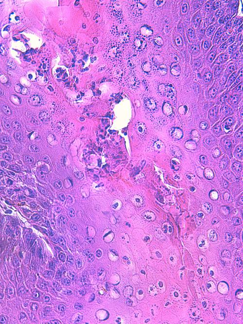 Un cas de pododermatite à ankylostomatidés chez un chien
