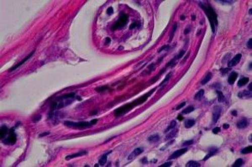 Un cas de pododermatite à ankylostomatidés chez un chien