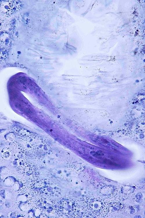 Un cas de pododermatite à ankylostomatidés chez un chien