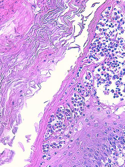 Un cas de pododermatite à ankylostomatidés chez un chien