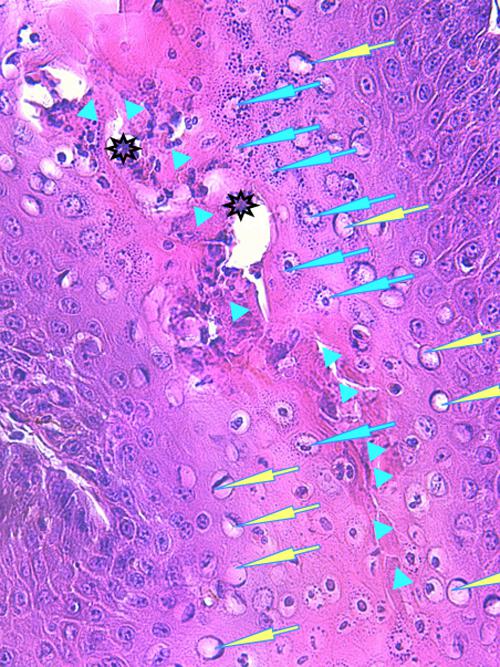 Un cas de pododermatite à ankylostomatidés chez un chien