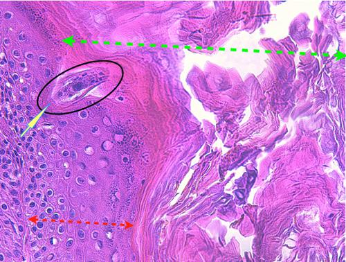 Un cas de pododermatite à ankylostomatidés chez un chien