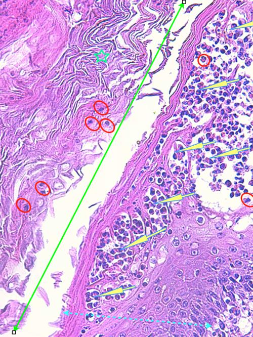 Un cas de pododermatite à ankylostomatidés chez un chien