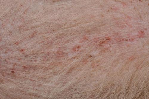 Un cas de pyodermite secondaire à une dermatite par allergie aux piqures de puces