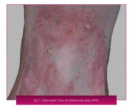 Un cas d'allergie de contact chronique liée à une allergie de contact chez un chien chinois à crête Un cas d'allergie de contact chronique liée à une allergie de contact chez un chien chinois à crête